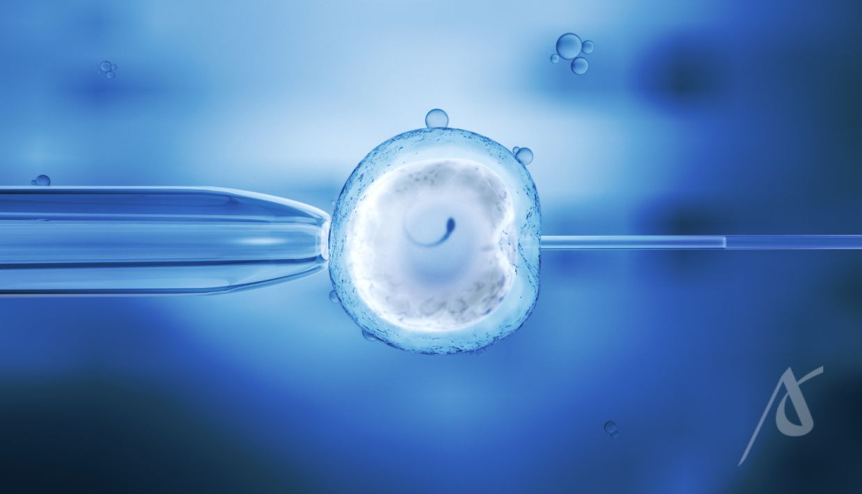Fertilização in vitro com ICSI