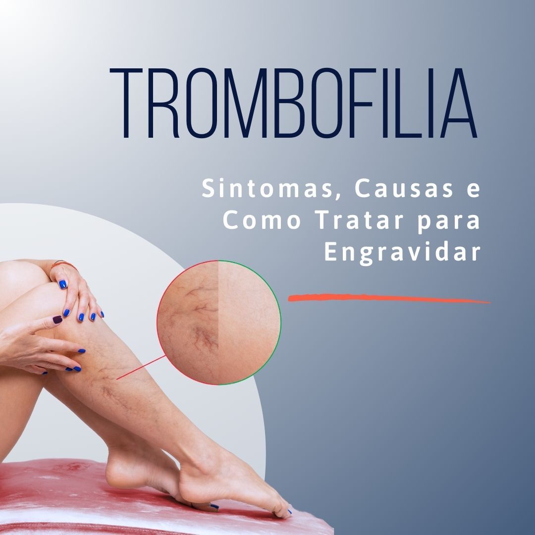 Trombofilia Sintomas