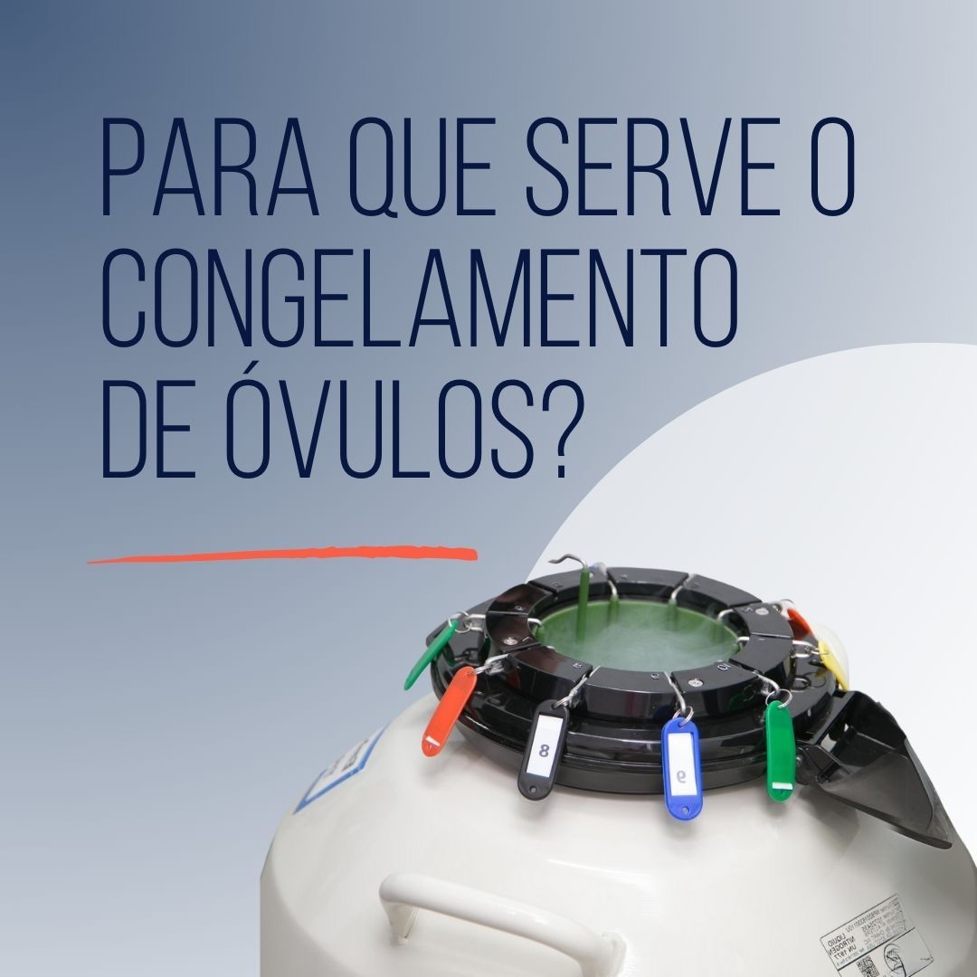 Para que serve o Congelamento de Óvulos?
